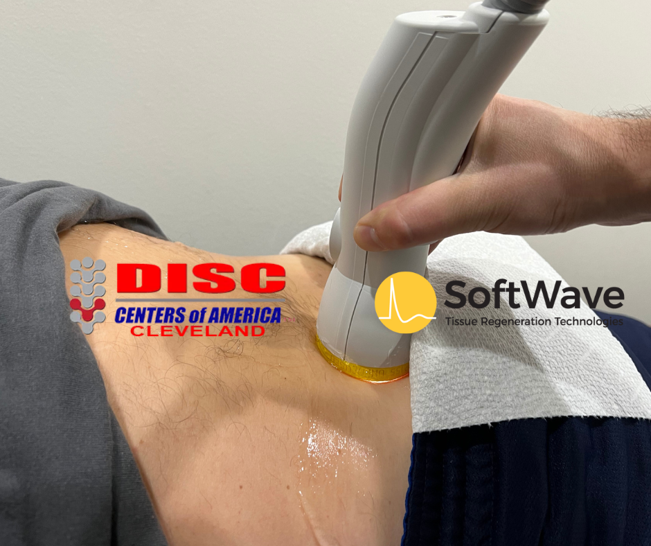 Sciatica Pain Relief with SoftWave Therapy at Disc Centers of America – Cleveland