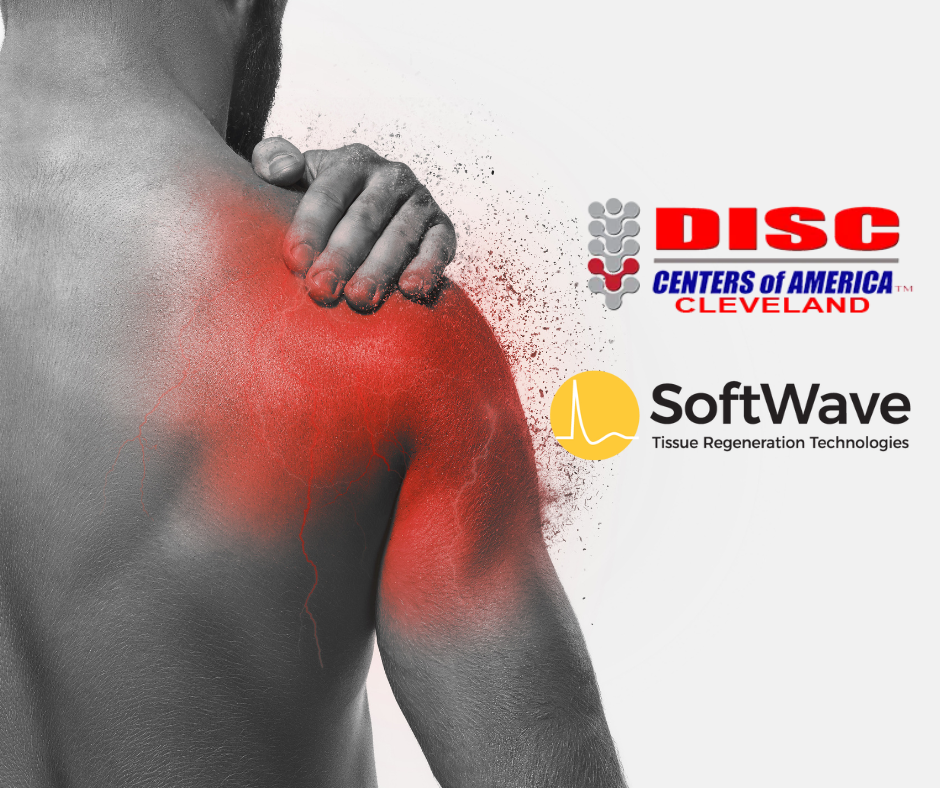 Advanced Shoulder Pain Relief with SoftWave Therapy at Disc Centers of America – Cleveland